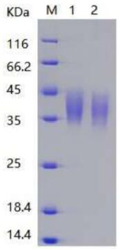 1. Reducing sample  2. Non-reducing sample Human CD200 (C-6His) stained by Coomassie Blue, showing >95% purity under reducing condition.